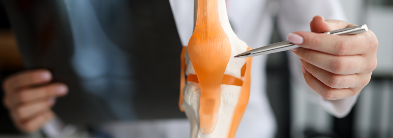 Medizinisches Fachpersonal, das die Ausrichtung des Knies eines Patienten auf Anzeichen einer Varus-Valgus-Gonarthrose untersucht.