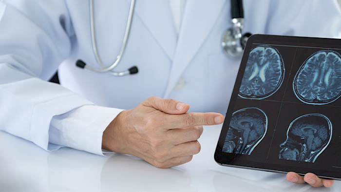 Doctor shows a scan of a head injury