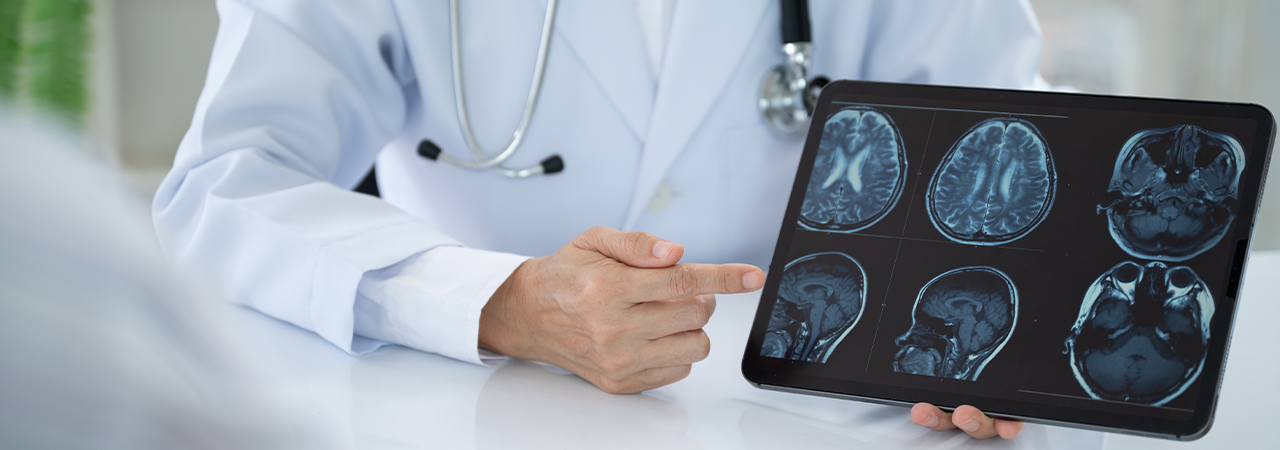 Doctor shows a scan of a head injury